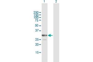 Western Blot analysis of ARMC10 expression in transfected 293T cell line by ARMC10 MaxPab polyclonal antibody. (ARMC10 anticorps  (AA 1-308))