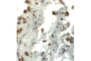 Immunohistochemical staining of human lung cells with EZH1 polyclonal antibody  at 5 ug/mL.