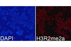Immunofluorescence analysis of 293T cells using Asymmetric DiMethyl-Histone H3-R2 antibody. (Histone 3 anticorps  (H3R2me2))
