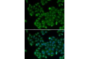 Immunofluorescence analysis of U20S cell using DNMT3L antibody. (DNMT3L anticorps)
