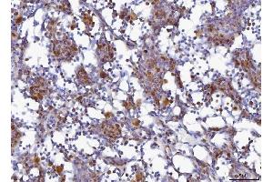 IHC analysis of MCM6 using anti-MCM6 antibody (ABIN7600035). (MCM6 anticorps  (AA 14-821))