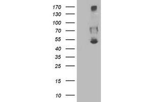 Western Blotting (WB) image for anti-Sedoheptulokinase (SHPK) antibody (ABIN1500923)