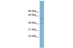 WB Suggested Anti-SUSD4 Antibody Titration:  0. (SUSD4 anticorps  (Middle Region))