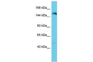 Host: Rabbit Target Name: ANKRD36B Sample Type: 721_B Whole Cell lysates Antibody Dilution: 1. (ANKRD36B anticorps  (C-Term))