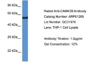 Western Blotting (WB) image for anti-Calcium/calmodulin-Dependent Protein Kinase II beta (CAMK2B) (Middle Region) antibody (ABIN2788743) (CAMK2B anticorps  (Middle Region))