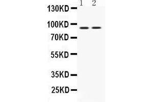 Western blot analysis of UHRF1 expression in MCF-7 whole cell lysates ( Lane 1) and U2OS whole cell lysates ( Lane 2). (UHRF1 anticorps  (N-Term))