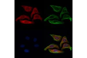 ABIN6261614 and ABIN6273044 staining Hela cells by IF/ICC. (ETFB anticorps  (Internal Region))