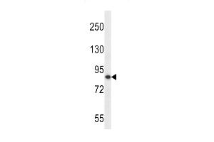 Western blot analysis in MDA-MB453 cell line lysates (35ug/lane).