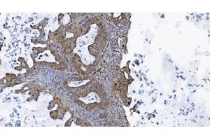 IHC analysis of SAMHD1 using anti-SAMHD1 antibody (ABIN7601514).