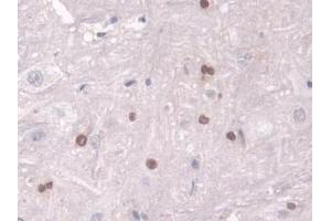 Detection of TKT in Rat Spinal cord Tissue using Polyclonal Antibody to Transketolase (TKT)