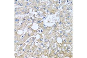 Immunohistochemistry of paraffin-embedded human liver injury using TUBGCP3 antibody. (TUBGCP3 anticorps  (AA 1-250))