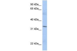 WB Suggested Anti-MRPL15 Antibody Titration:  0. (MRPL15 anticorps  (N-Term))