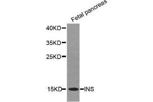 Western Blotting (WB) image for anti-Insulin (INS) (AA 1-110) antibody (ABIN6219279) (Insulin anticorps  (AA 1-110))