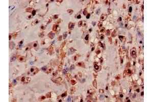 Immunohistochemistry of paraffin-embedded human placenta tissue using ABIN7142365 at dilution of 1:100 (MRPL19 anticorps  (AA 1-292))