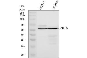 Western blot analysis of NFIA using anti-NFIA antibody (ABIN4886680).