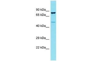 Host: Rabbit Target Name: CCDC121 Sample Type: OVCAR-3 Whole Cell lysates Antibody Dilution: 1. (CCDC121 anticorps  (Middle Region))