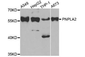 Western blot analysis of extracts of various cell lines, using PNPLA2 antibody. (PNPLA2 anticorps  (AA 265-504))