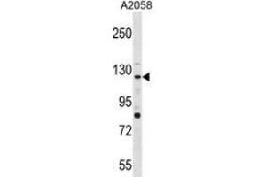 Western blot analysis in A2058 cell line lysates (35ug/lane) using PTPRN2  Antibody . (PTPRN2 anticorps  (N-Term))