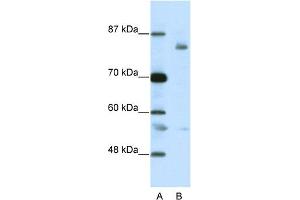 WB Suggested Anti-LZTR1 Antibody Titration:  2. (LZTR1 anticorps  (C-Term))