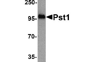 Western blot analysis of TM yeast Pst1 protein (50 ng) with Pst1 antibody at 1 µg/mL. (ST8SIA4 anticorps  (N-Term))