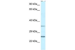 Western Blot showing PPP1R2 antibody used at a concentration of 1 ug/ml against THP-1 Cell Lysate