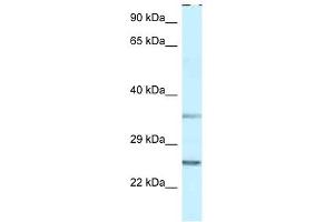 Western Blot showing PPP1R2 antibody used at a concentration of 1 ug/ml against THP-1 Cell Lysate (PPP1R2 anticorps  (N-Term))