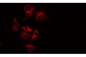 ABIN6269242 staining LOVO by IF/ICC. (CASR anticorps  (C-Term))