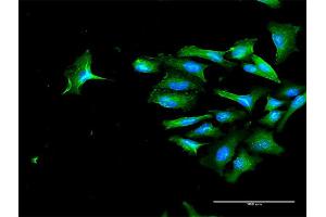 Immunofluorescence of purified MaxPab antibody to CD44 on HeLa cell. (CD44 anticorps  (AA 1-361))