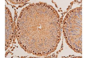 ABIN6267221 at 1/100 staining rat testicular tissue sections by IHC-P.