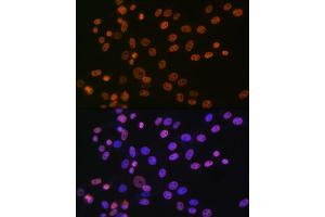Immunofluorescence analysis of NIH-3T3 cells using hnRNP  Rabbit mAb (1564) at dilution of 1:100 (40x lens).