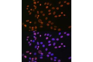 Immunofluorescence analysis of NIH-3T3 cells using hnRNP  Rabbit mAb (1564) at dilution of 1:100 (40x lens). (HNRNPA1 anticorps)
