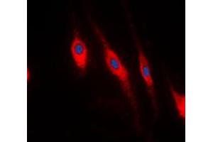 Immunofluorescent analysis of PDLIM1 staining in HeLa cells.