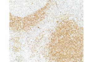 Immunohistochemistry (IHC) image for anti-B-cell antigen receptor complex-associated protein alpha chain (CD79A) (AA 176-226) antibody (ABIN7454005) (Recombinant CD79a anticorps  (AA 176-226))