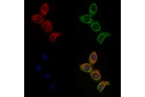 ABIN6257980 and ABIN6275676 staining HepG2 cells by IF/ICC.