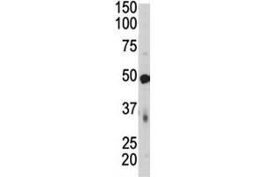 Western blot of PDK4 antibody and mouse skeletal muscle tissue lysate. (PDK4 anticorps  (AA 382-410))