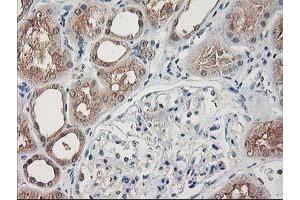 Immunohistochemical staining of paraffin-embedded Human Kidney tissue using anti-NIF3L1 mouse monoclonal antibody. (NIF3L1 anticorps)