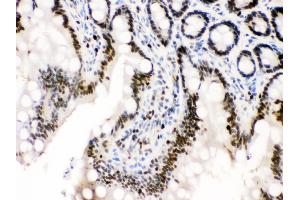 Anti-MCM3 antibody, IHC(P) IHC(P): Rat Intestine Tissue