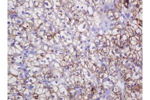 Image no. 3 for anti-Carbonic Anhydrase 12 (CA12) antibody (ABIN1497067)