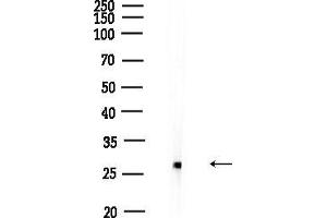 anti-Solute Carrier Family 25, Member 27 (SLC25A27) (C-Term) antibody