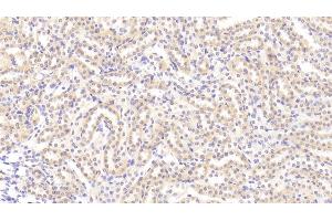 Detection of TL1A in Rat Kidney Tissue using Polyclonal Antibody to TNF Like Ligand 1A (TL1A)