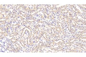Detection of TL1A in Rat Kidney Tissue using Polyclonal Antibody to TNF Like Ligand 1A (TL1A) (TNF Like Ligand 1A (AA 70-230) anticorps)