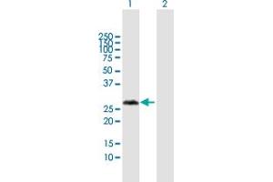 Western Blot analysis of VCX3A expression in transfected 293T cell line by VCX3A MaxPab polyclonal antibody. (VCX3A anticorps  (AA 1-166))