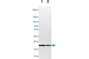Western blot analysis of Lane 1: NIH-3T3 cell lysate (Mouse embryonic fibroblast cells), Lane 2: NBT-II cell lysate (Rat Wistar bladder tumour cells) with TOMM22 polyclonal antibody  at 1:100-1:500 dilution. (TOMM22 anticorps)