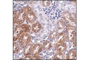 Immunohistochemistry of LIAR in mouse kidney tissue AP30506PU-N antibody at 2. (ANKRD54 anticorps  (C-Term))