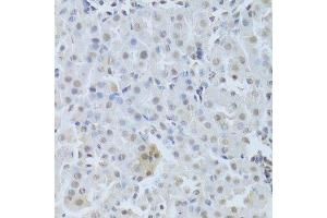 Immunohistochemistry of paraffin-embedded mouse kidney using CDK4 Antibody.
