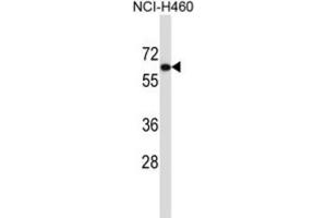 Western Blotting (WB) image for anti-UDP Glucuronosyltransferase 2 Family, Polypeptide B11 (UGT2B11) antibody (ABIN2997370) (UGT2B11 anticorps)