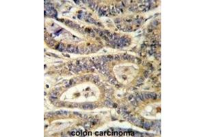 Immunohistochemistry (IHC) image for anti-Insulin-Like Growth Factor Binding Protein 6 (IGFBP6) antibody (ABIN3002791)