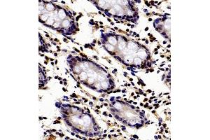 Immunohistochemistry of paraffin embedded human colon using Api5 (ABIN7073094) at dilution of 1:350 (400x lens)