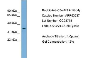 WB Suggested Anti-C3orf49  Antibody Titration: 0. (C3orf49 anticorps  (Middle Region))