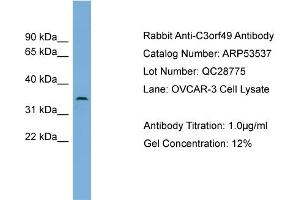 WB Suggested Anti-C3orf49  Antibody Titration: 0.
